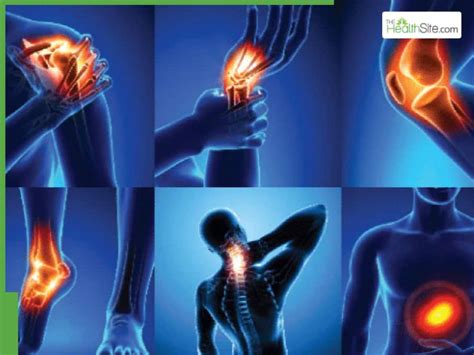 Bone Pain In Winter: Why Cold Weather Triggers Joint Problems And How ...