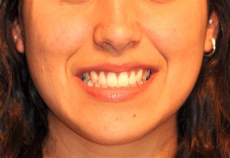 Ortodoncia Borja | Qué podemos hacer por ti