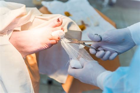 Image result for Toe Surgery