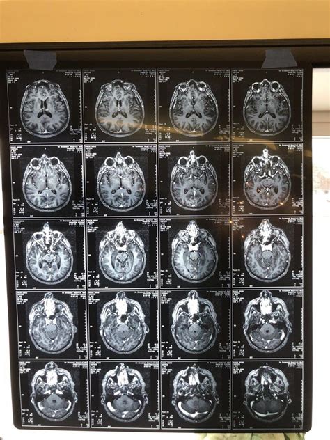 Image result for Human Brain Scan