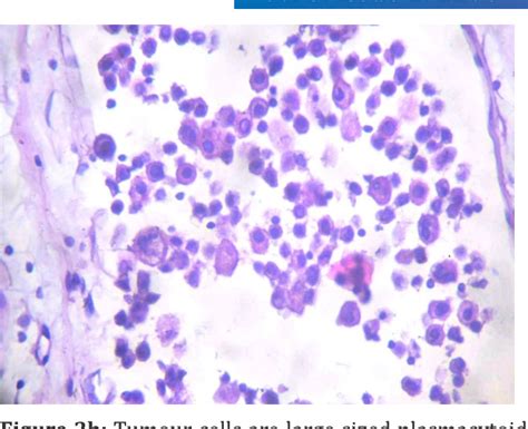 Image result for Python HackerRank Silver Badge