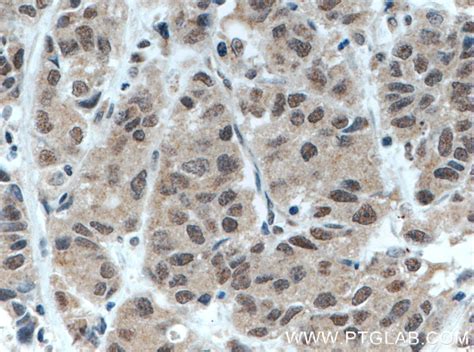 BRD3 antibody (11859-1-AP) | Proteintech