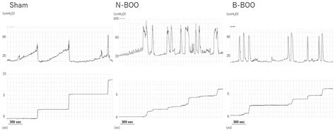 Blueberry Prevents the Bladder Dysfunction in Bladder Outlet ...