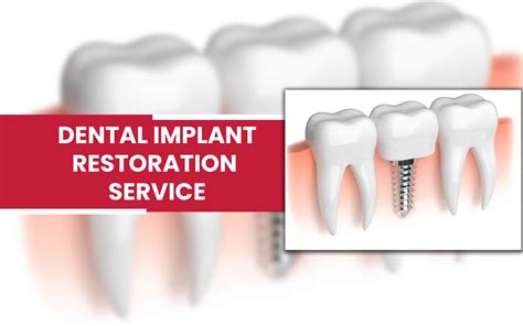 Dental Implants in Tucson, AZ| Wilmot Family Dentistry