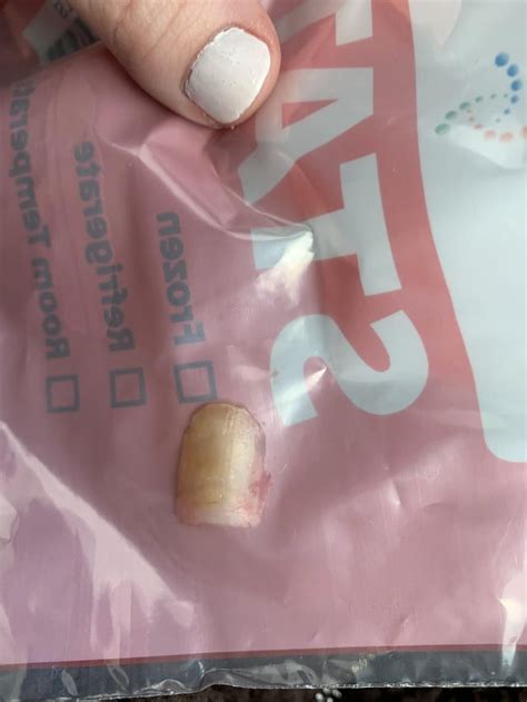 Full Toenail Extraction 的图像结果