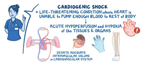 Video: Shock - Cardiogenic: Nursing | Osmosis