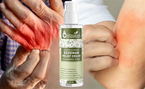 Chitaaksh Eczemaron Fungal Cream For Men & Women Ayurvedic Itchcoat ...