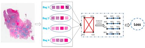 Recent Advances of Deep Learning for Computational Histopathology ...