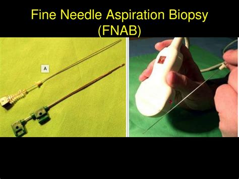 PPT - Nonvascular Interventions PowerPoint Presentation, free download ...