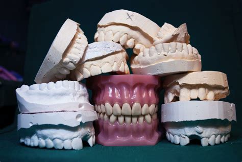 Dental Secrets: Celebrities and Their Complete Dentures - Unearthing ...