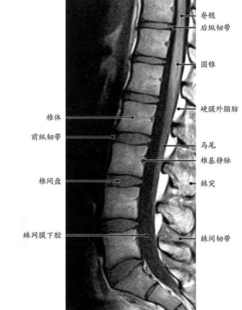正常腰椎影像解剖图-医学影像图,_医学图库