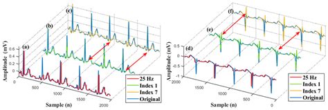 A Novel Method for ECG Signal Compression and Reconstruction: Down ...