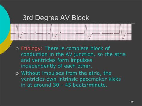Image result for ACLS Code Blue Algorithm