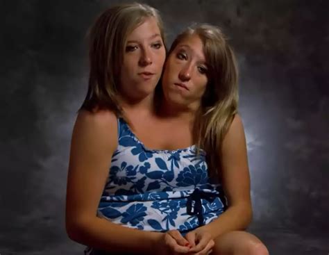 Conjoined twin Brittany Hensel’s rights now her sister is legally married
