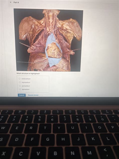 Which structure is highlighted? endocardium myocardium pericardium epica..