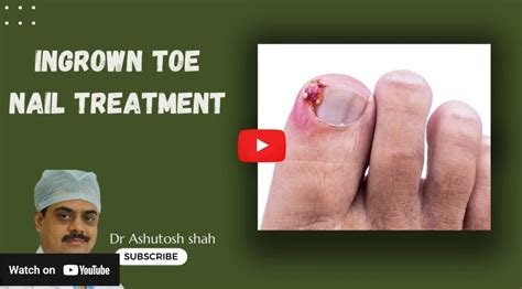 Top 5 Nail Signs to Watch for Your Health: Diabetic Foot Care