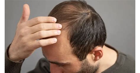 Dr Batra’s® Healthcare Introduces World’s Most Advanced Treatment for ...