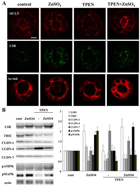 Increase in Epithelial Permeability and Cell Metabolism by High ...