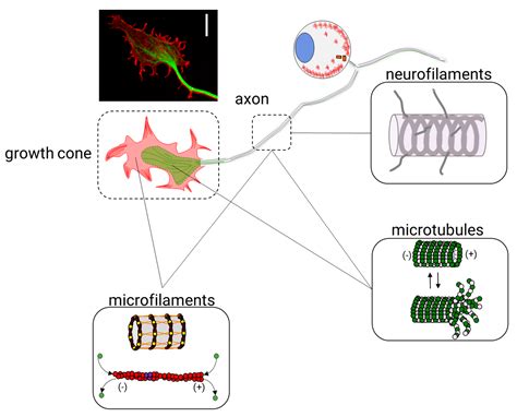 Much More Than a Scaffold: Cytoskeletal Proteins in Neurological Disorders