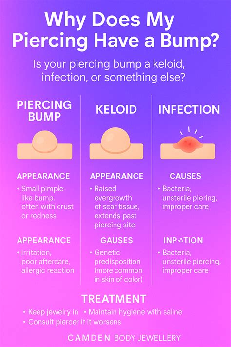 Keloid Vs Irritation Bump