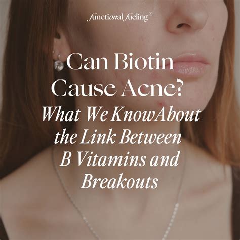 Can Biotin Cause Acne? The Link Between B Vitamins and Breakouts