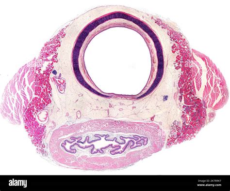 Light micrograph showing a cross-section of the neck. At top is the ...