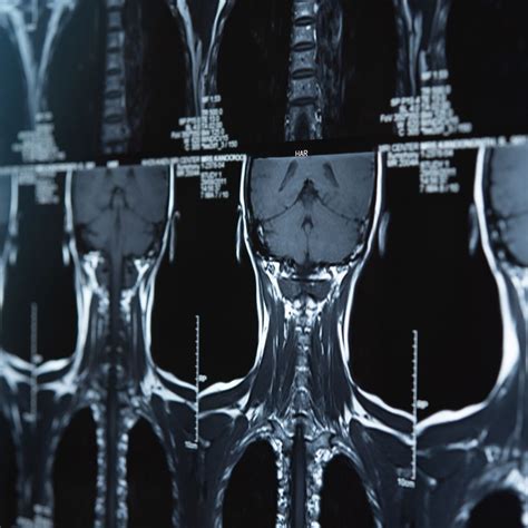 Evolving concepts in oligometastatic head and neck cancer - Onkologie ...