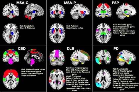 Projects - Neural Engineering Lab, IIT Guwahati