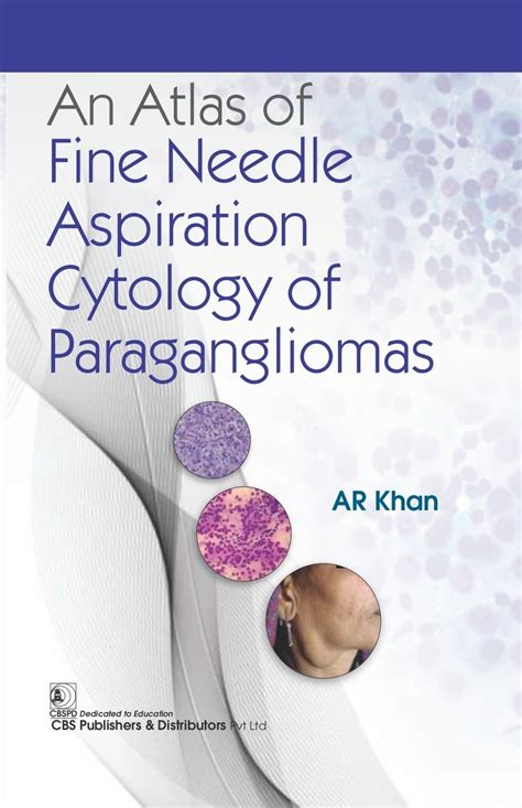 Buy An Atlas of Fine Needle Aspiration Cytology of Paragangliomas Book ...