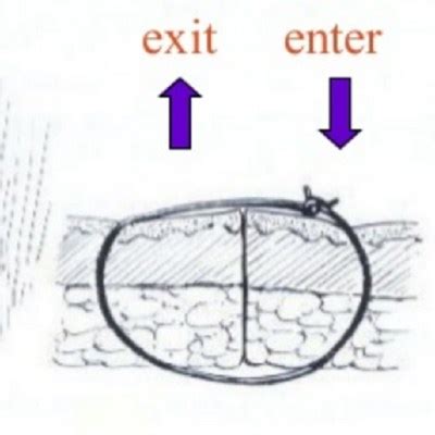 Image result for Continuous Suture Patterns