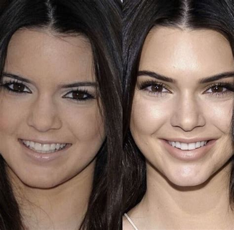 Bildergebnis für top+lip+surgeons