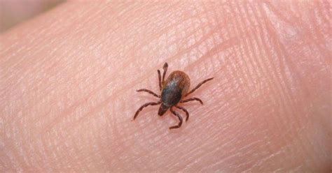 China’s Tick-Borne Virus: All You Need To Know