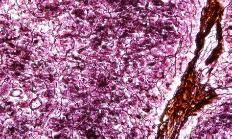 Reticular Connective Tissue Fibrous Connective Tissue