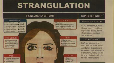 Image result for Famous Strangling Cases