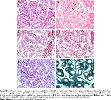 glomerular basement membrane