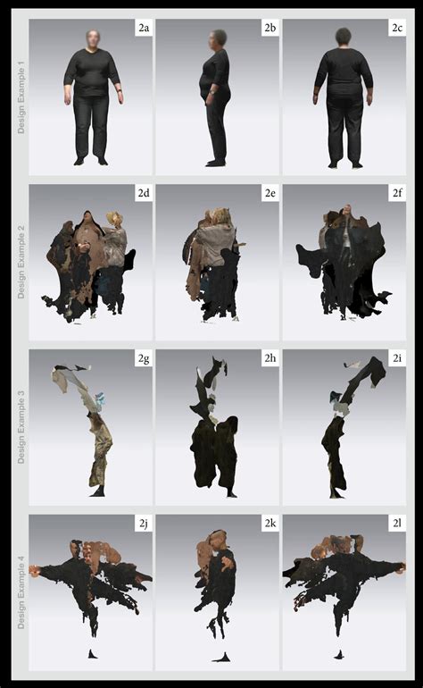 Image result for Scanning Process for Scan Body and Model