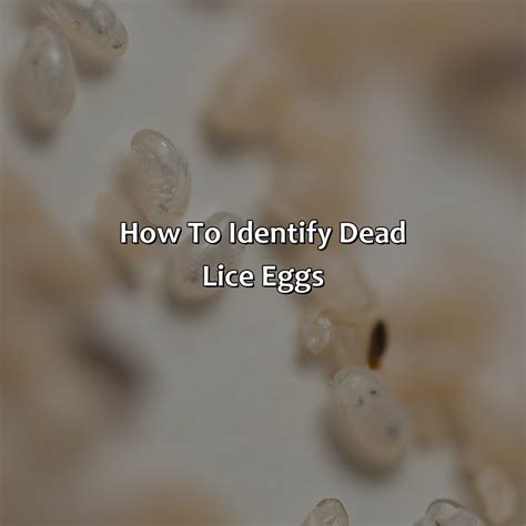 What Color Are Dead Lice Eggs - colorscombo.com