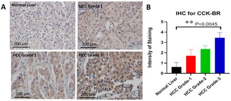 Treatment with a Cholecystokinin Receptor Antagonist, Proglumide ...