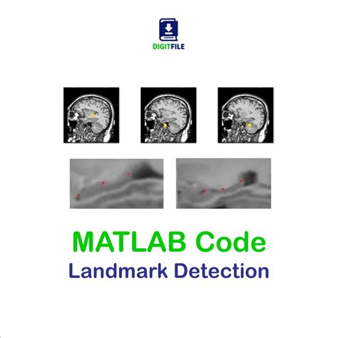Image result for Defect Detection Using SVM in MATLAB