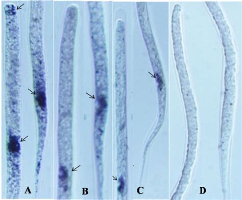The effect of DEC, NTZ and NTZ+AgNPs on the TCA cycle enzymes of the ...