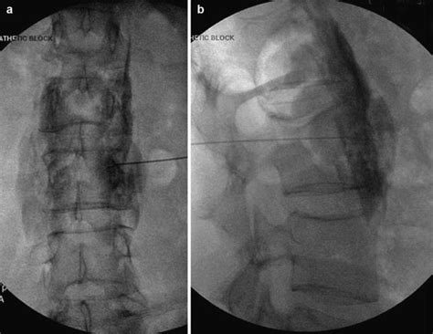 Pain & Spine Experts