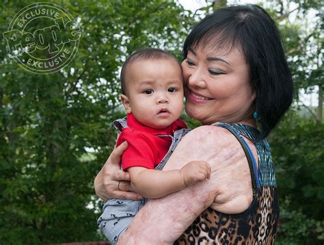 Vietnam War's 'Napalm Girl' Kim Phuc Sees Her Scars as Beautiful ...