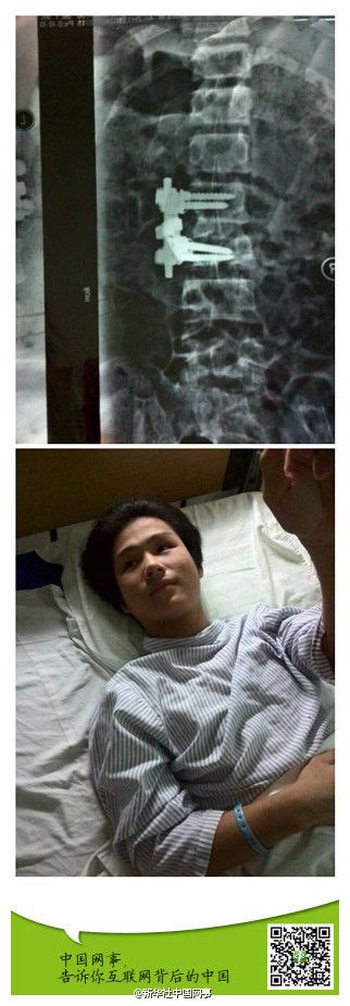 海南13岁学生因迟到被老师扇耳光 跳楼摔断腰-搜狐新闻