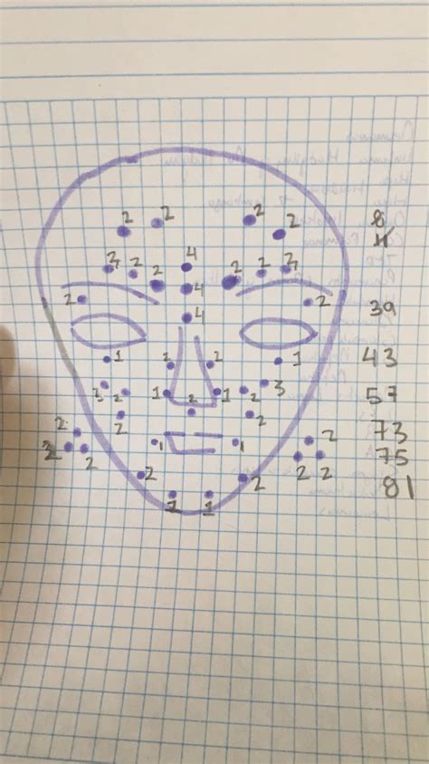 Image result for Botox Injection Patterns