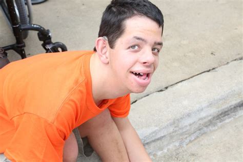 Coffin-Lowry Syndrome - Positive Exposure