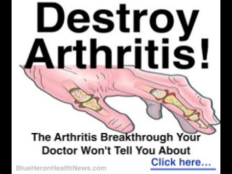 Cure Arthritis Naturally - YouTube