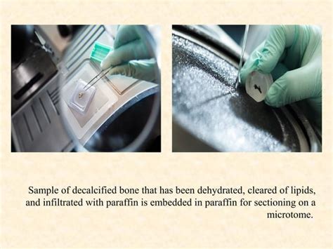 Tissue Processing in Histopathology 的图像结果