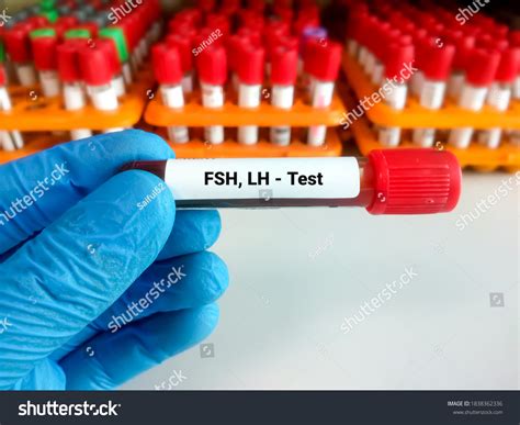 Blood Sample Tube Fsh Lh Follicle Stock Photo 1838362336 | Shutterstock