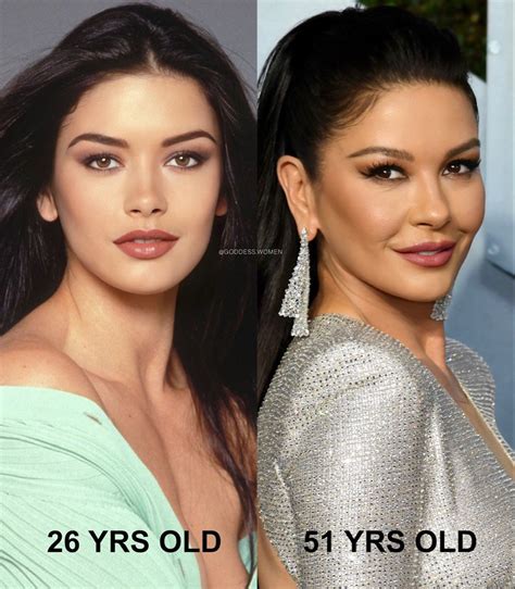 Catherine Zetajones Face Surgery