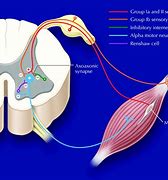 Image result for spasticity